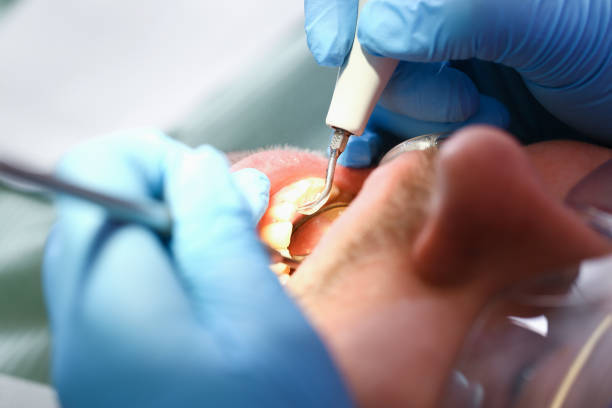 Best Walk-In Emergency Dental Services in Central, SC