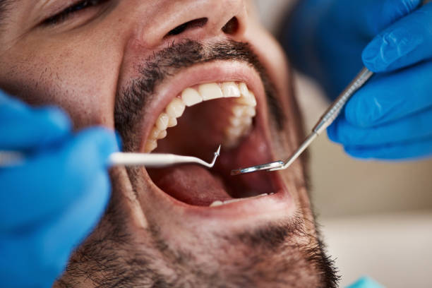 Best Dental Abscess Treatment in Central, SC